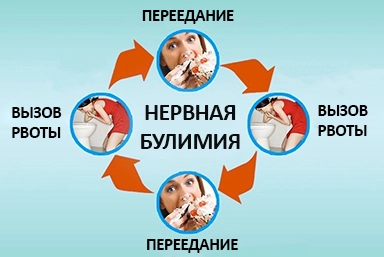 Лечение булимии в Бологом